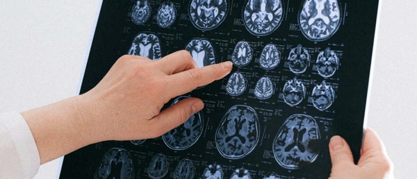 Translating Brain Activity into Images - The Immense Potential of Diffusion Models - Flow Card Image